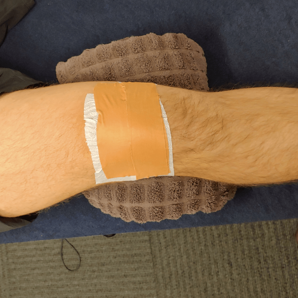 Get Into The Groove With McConnell Knee Taping