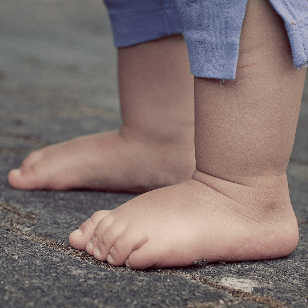 I Have ‘Flat Feet’ –  Should I Do Something About It? 