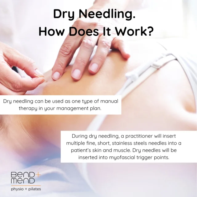 Dry needling can be effective for short term symptom relief and is another tool in a physiotherapist’s toolbox. However, it should always be used as part of a robust management plan, which includes exercise-based therapy.#physiosydneycbd #sportsphysio #bendandmend #dryneedling #dryneedlingphysio