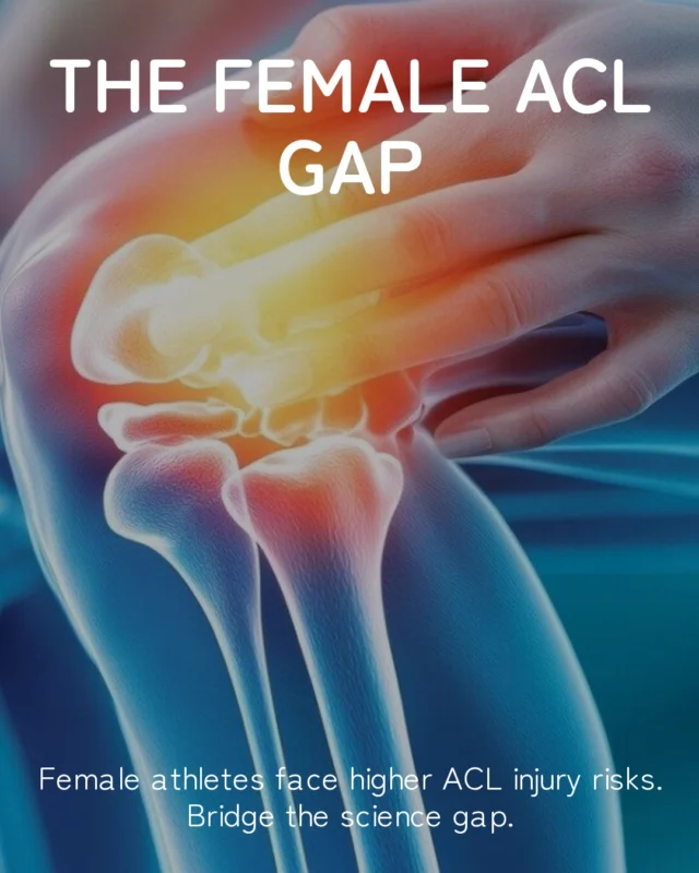Women are more prone to ACL injuries for a number of reasons.
1. Women have a smaller intracondular notch (an anatomical variant)
2. Their ACL is smaller in size and therefore not as strong.
3. Women have laxer ligaments in general.
But we can bridge the gap with tailored training and injury prevention.#SydneyPhysio #PhysioNearMe #aclrecovery #SportsPhysio #bendandmend