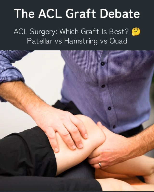 The overall aim of an anterior cruciate ligament (ACL) reconstruction is to restore stability to the knee preventing the forwards movement of the shin bone on the thigh bone and to provide rotational stability. In an ideal world the chosen graft should recreate the anatomical, structural and functional properties of the original ACL.#PhysioNearMe #aclrecovery #SydneyPhysio #SportsPhysio #bendandmend