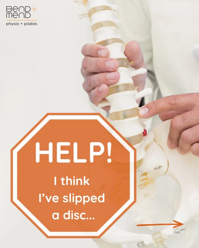 The term ‘slipped disc’ is not actually a medical term. It is commonly used to describe a disc herniation or disc prolapse. This occurs when the inner gel-like nucleus pulposus pushes through a tear or weakness in the outer annulus fibrosis.#bendandmend #slippeddisc #sydneyphysio #spinephysio #martinplacephysio